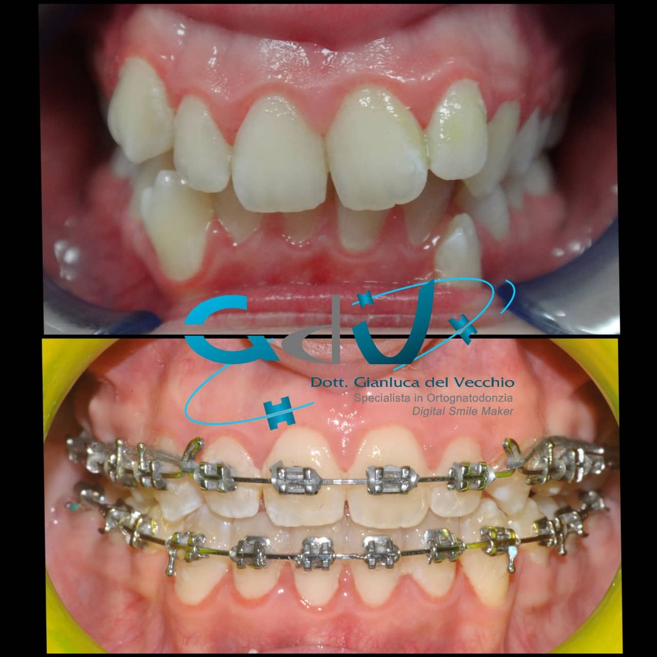 Gianluca Del Vecchio-119