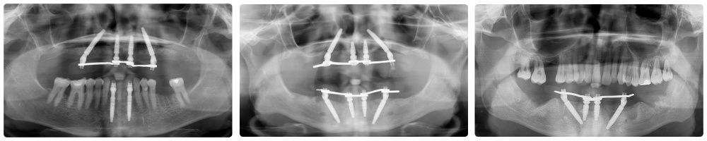 Agnieszka Ewa Sicińska-11