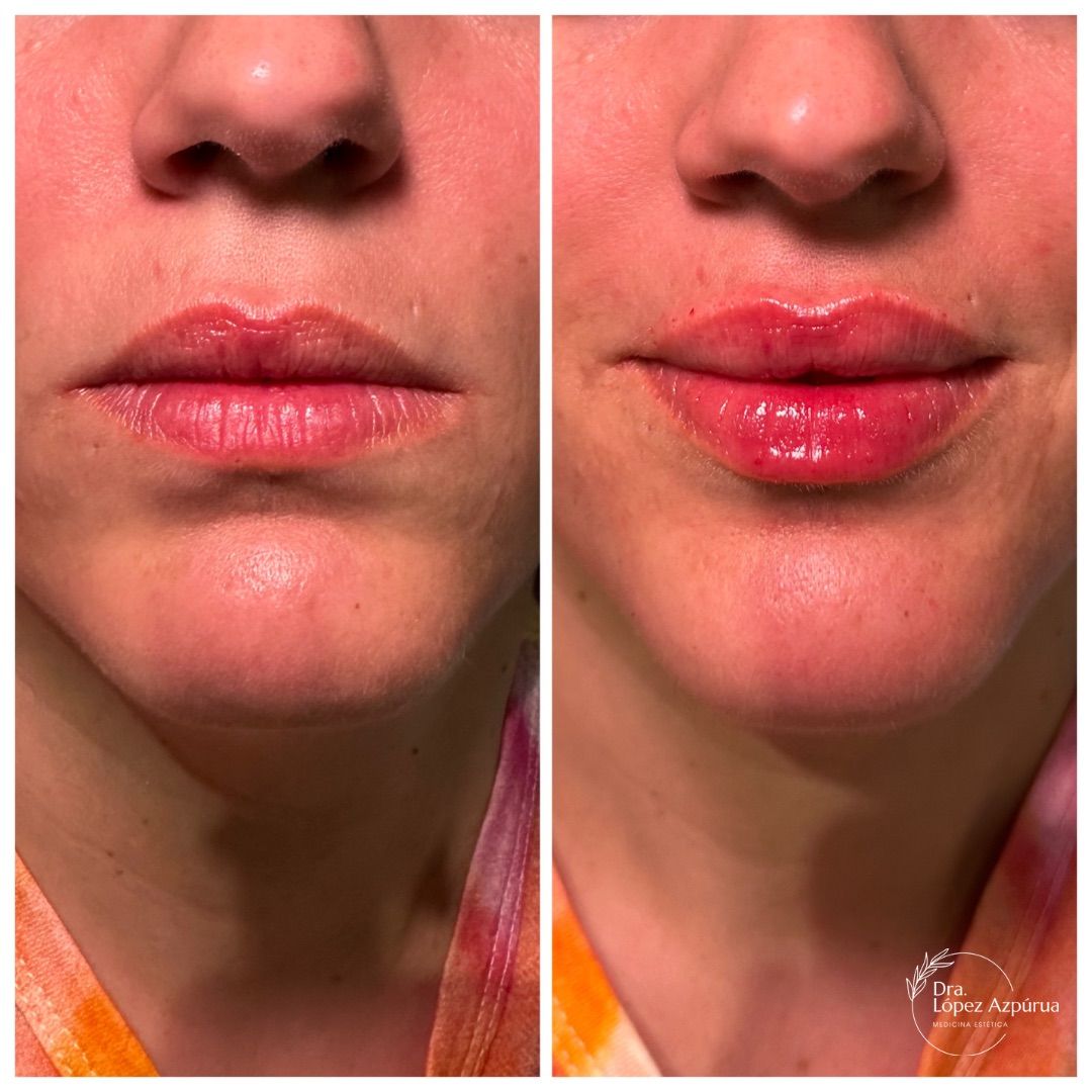 Alexandra López Azpúrua-3