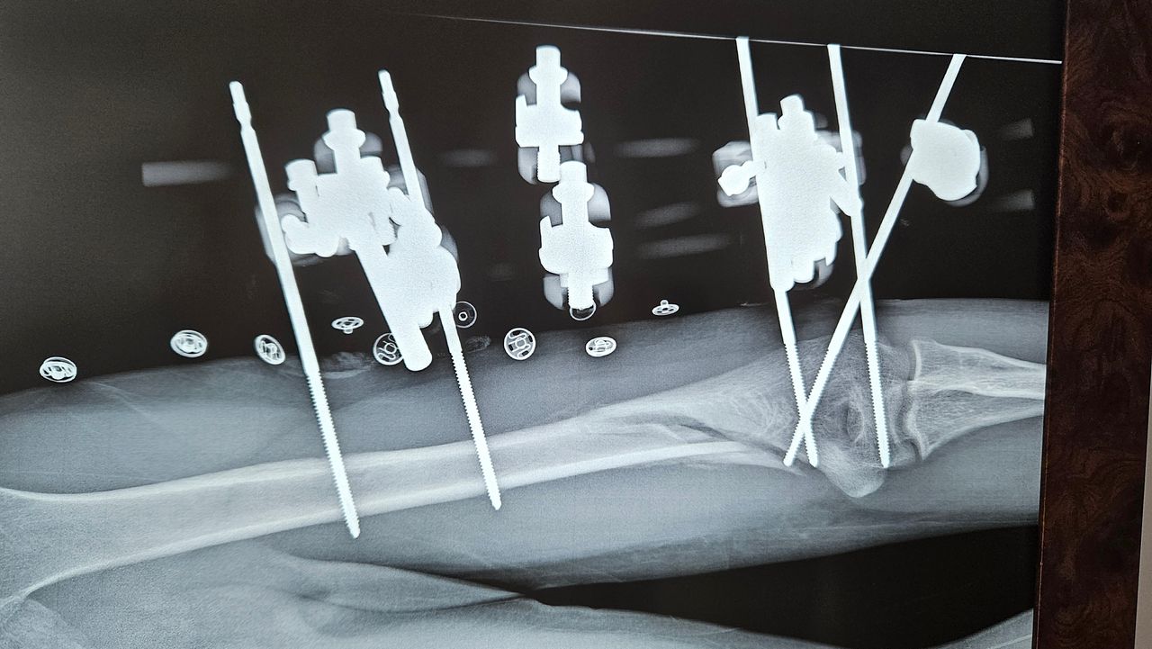 Gennaro Campopiano-13