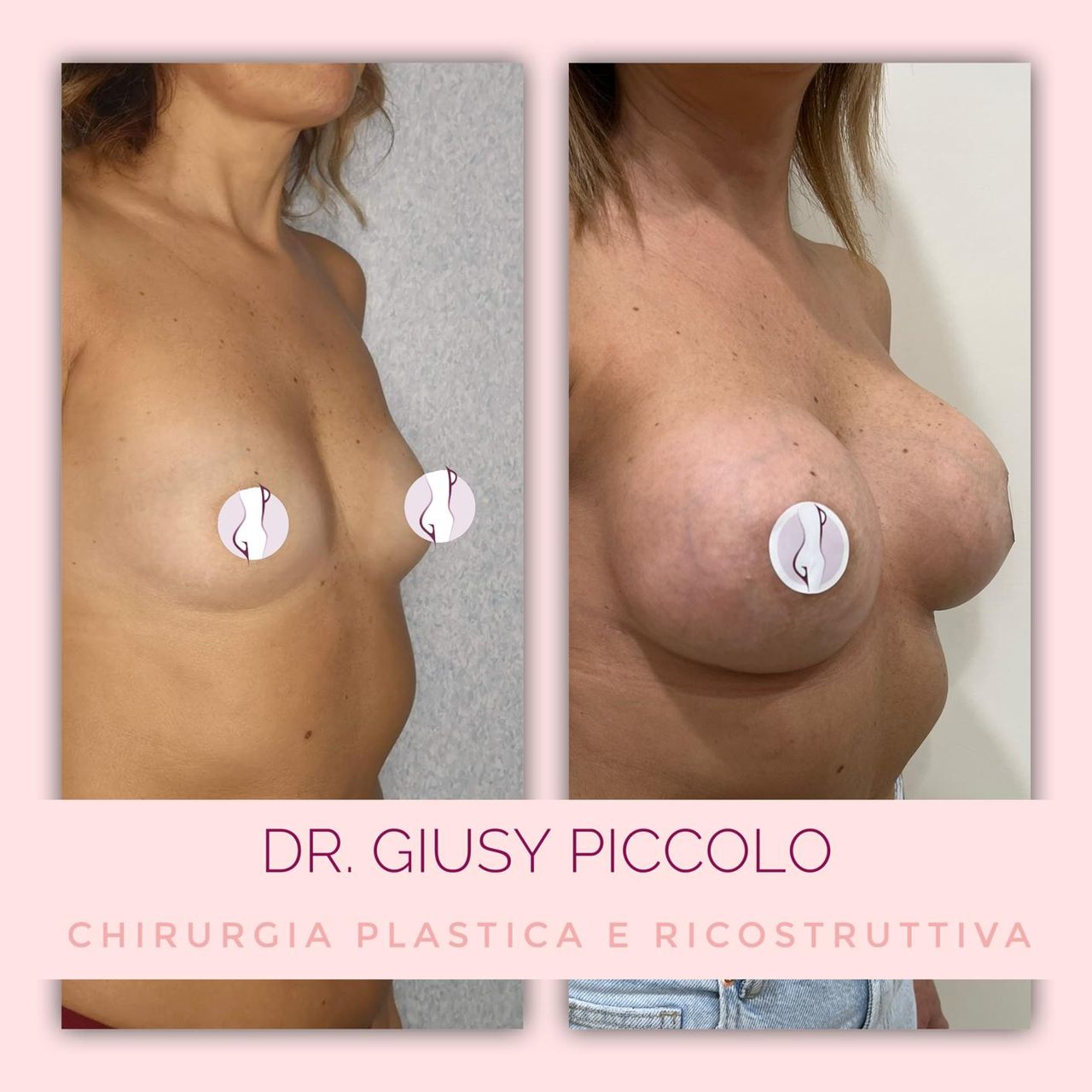 Giuseppina Piccolo-24