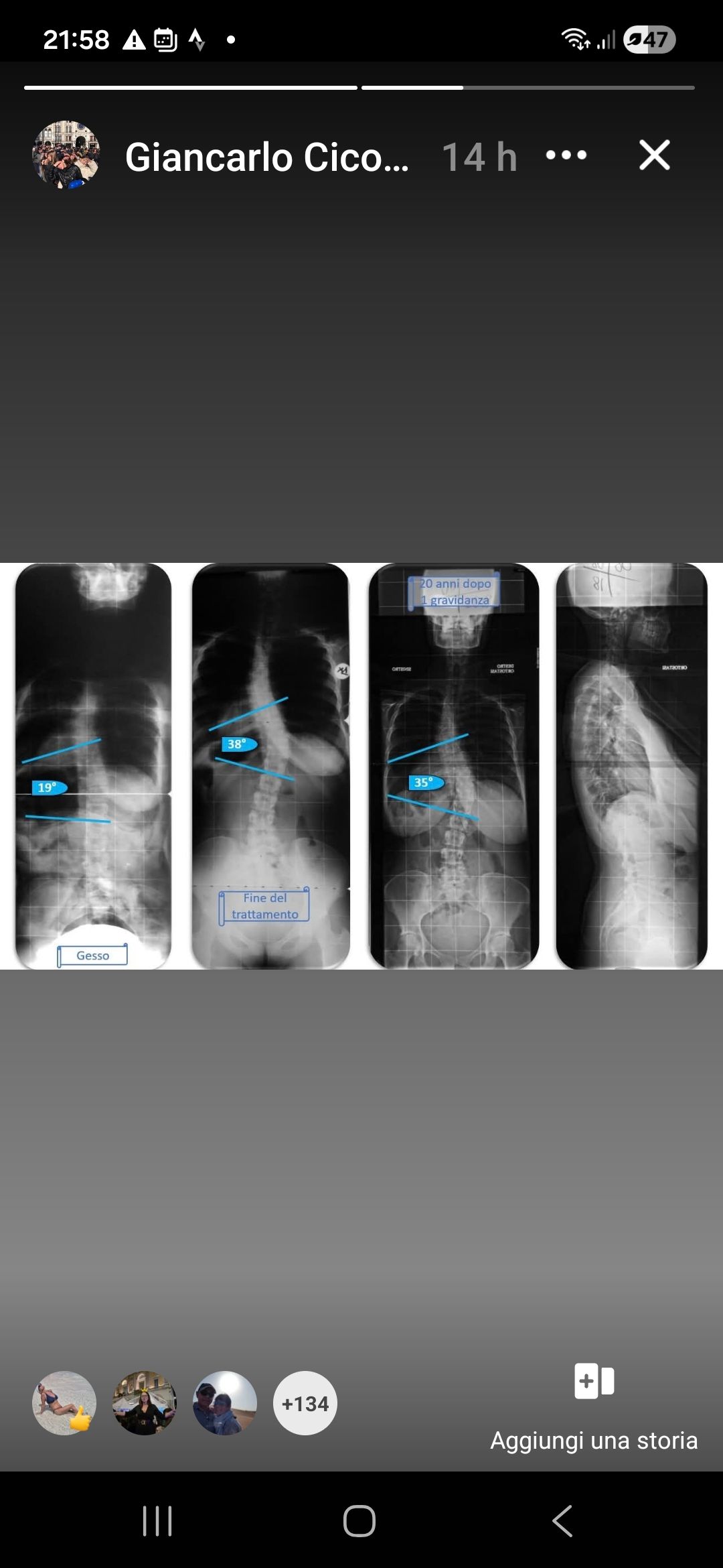 Giancarlo Cicogna-10