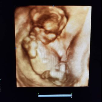 Hakan İbrahim Boyar-6