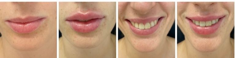 Silvia Melania Baio-11