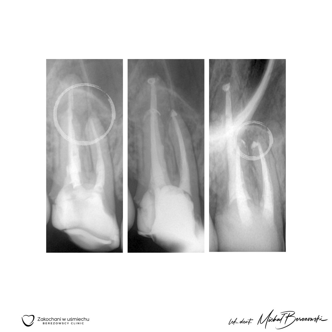 Michał Berezowski-43