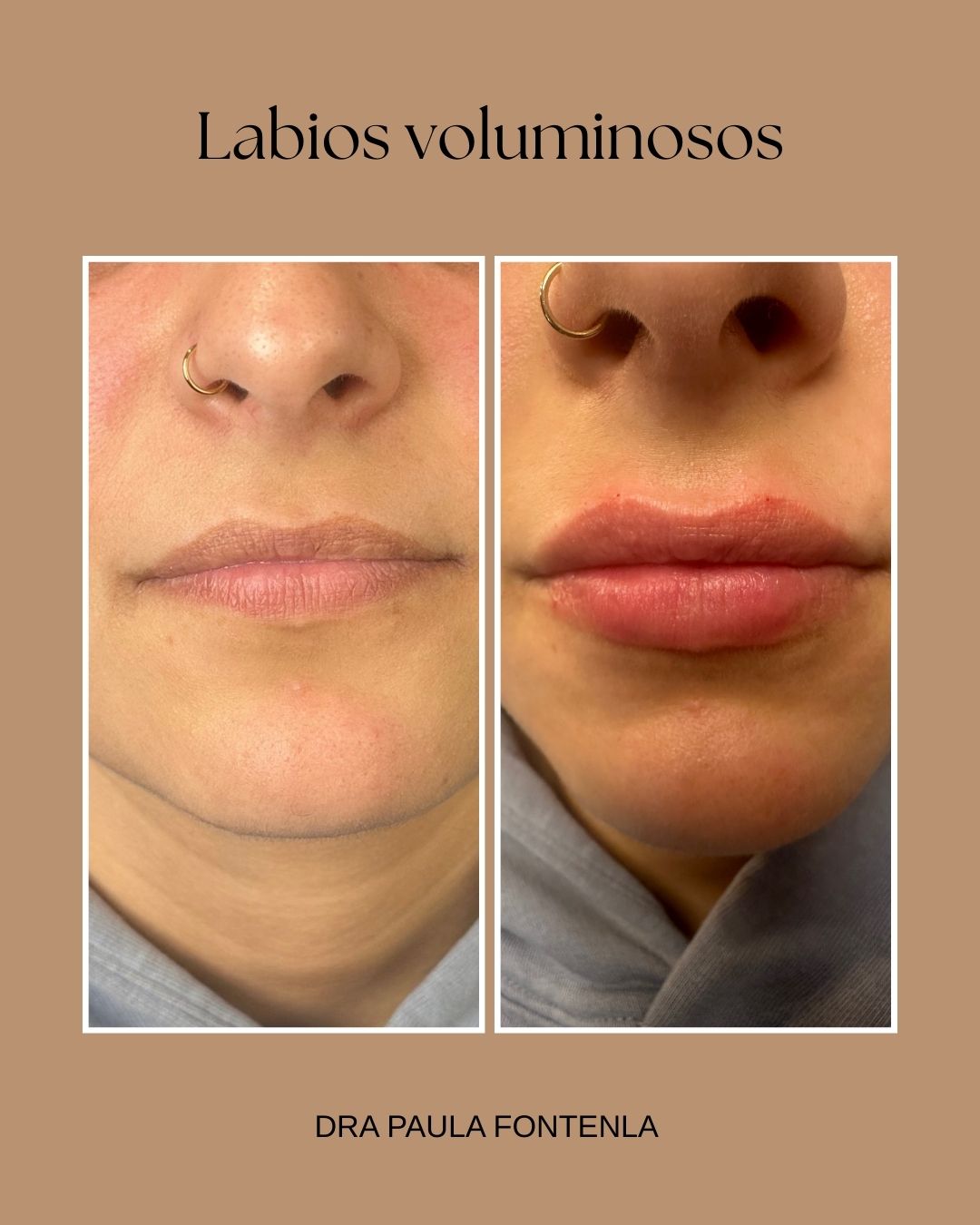 Paula Fontenla Seco-17