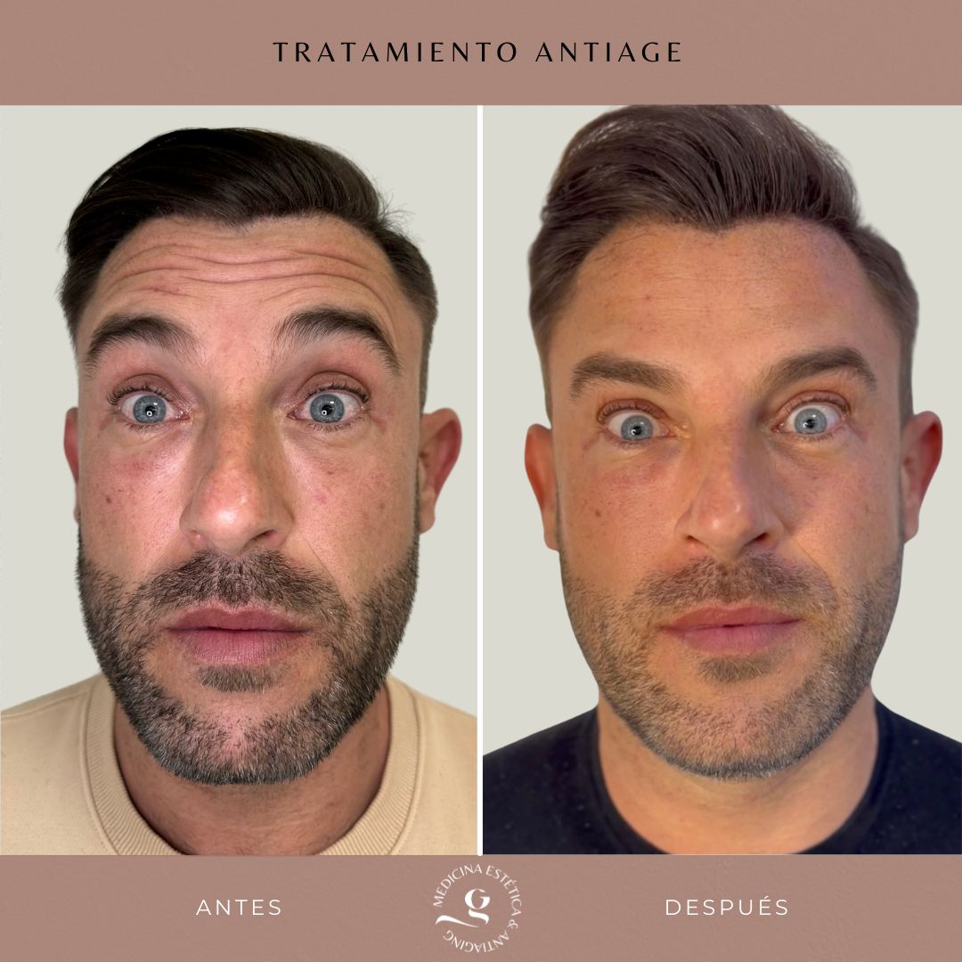 ​Giovanni Giorgianni-13