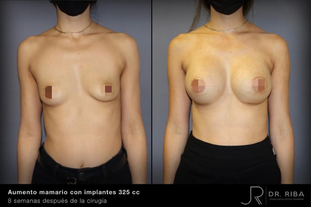 Jordi Riba Vilchez-40