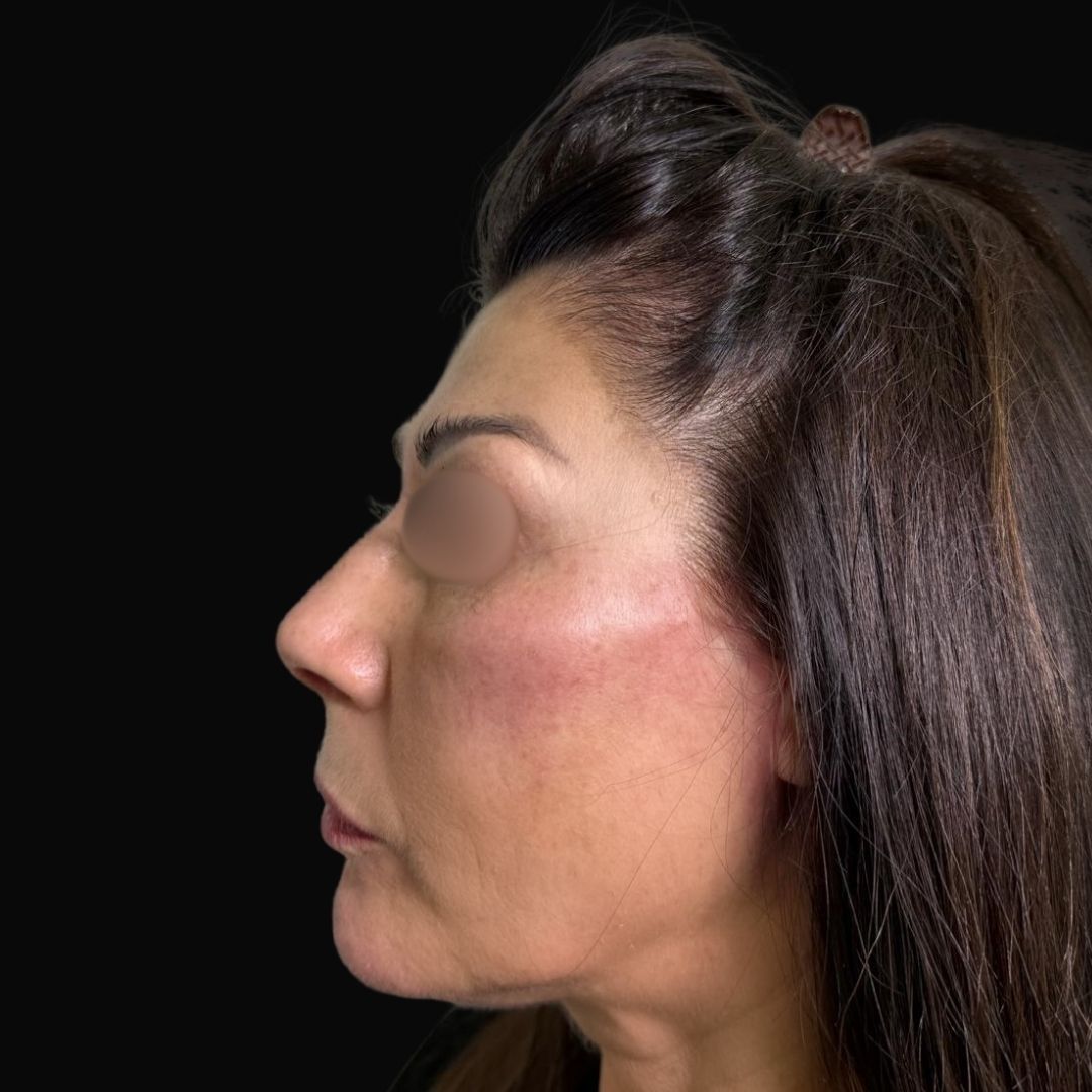 Pierfederico Perazzini-7