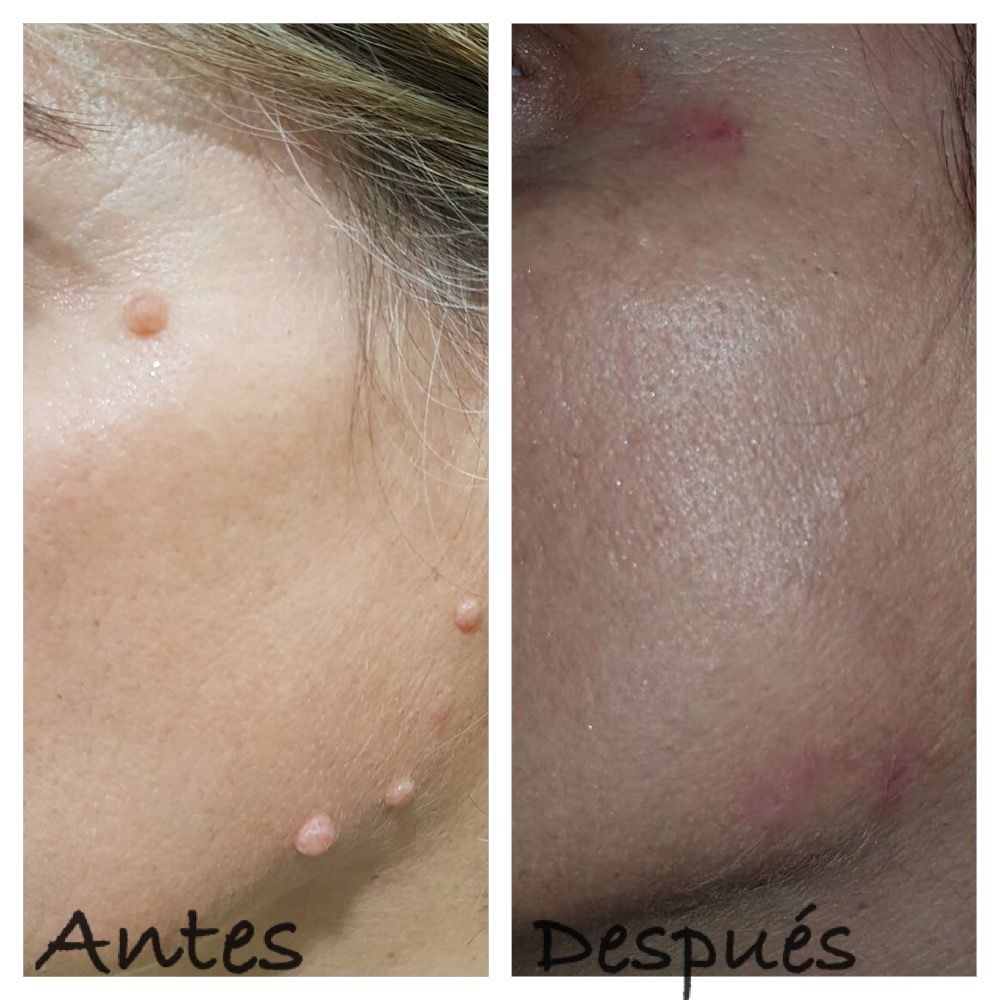 Rafael Gonzalez Oñate-17