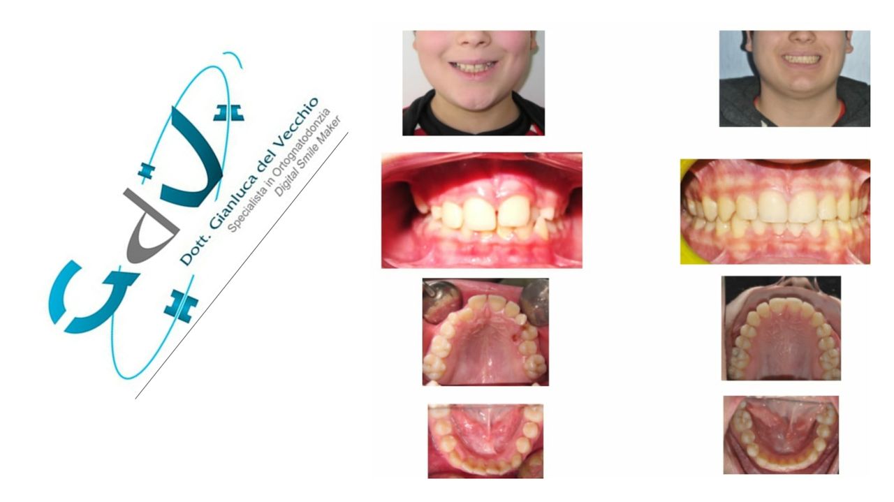 Gianluca Del Vecchio-90