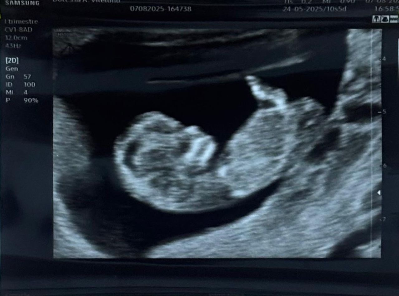 Andreina Vitellino-9