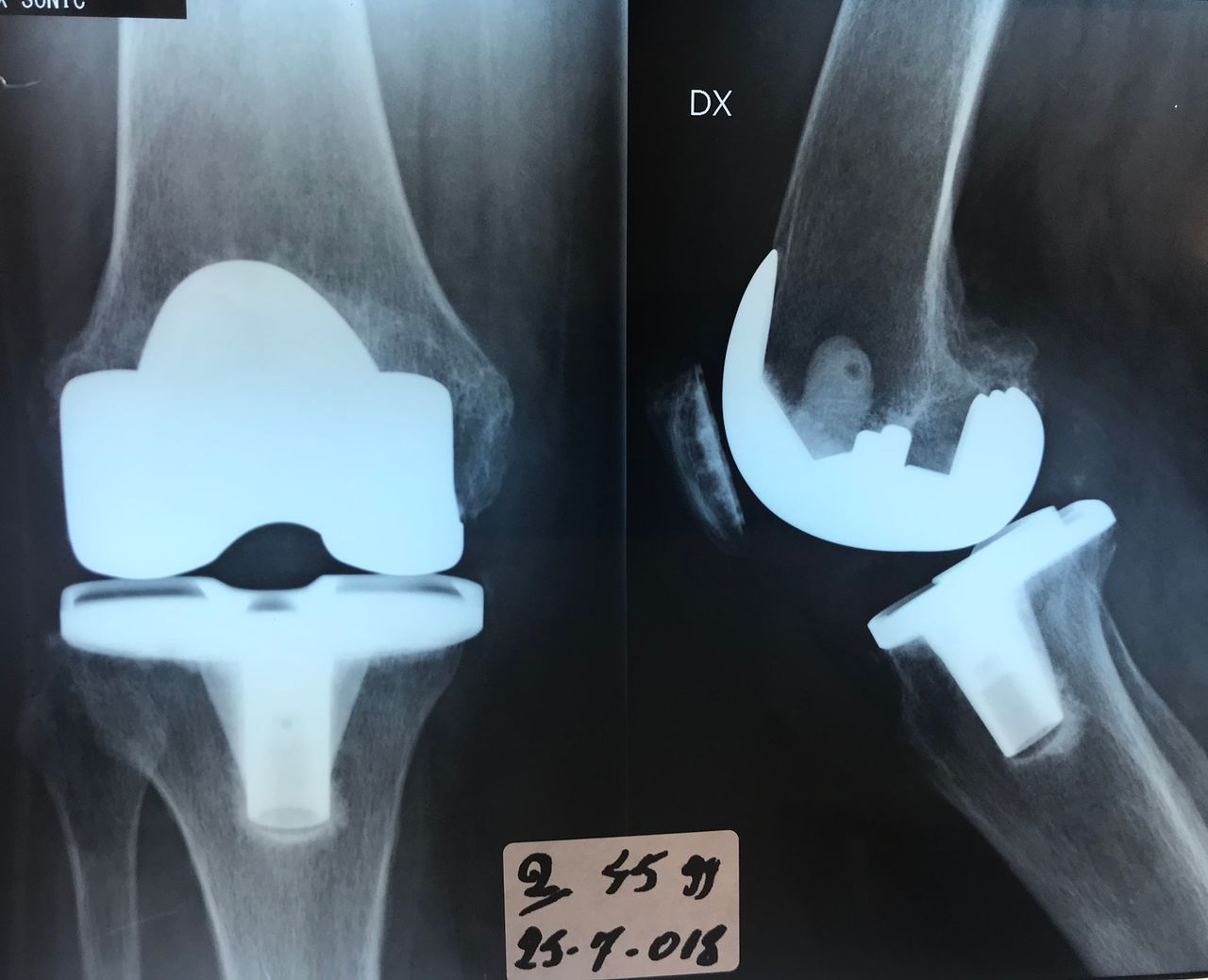 Alberto Maria Bonifazi-6