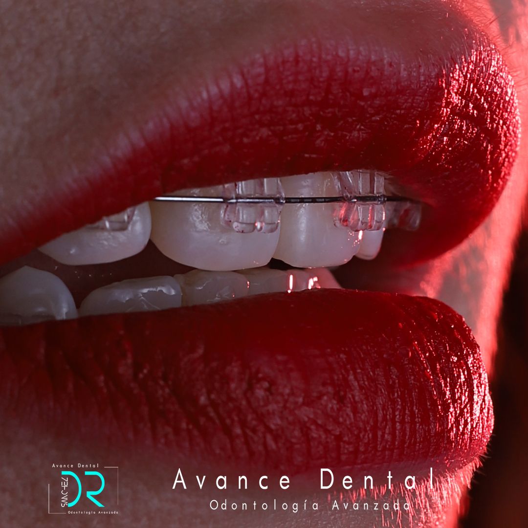 Juan Carlos Sánchez Pérez-6