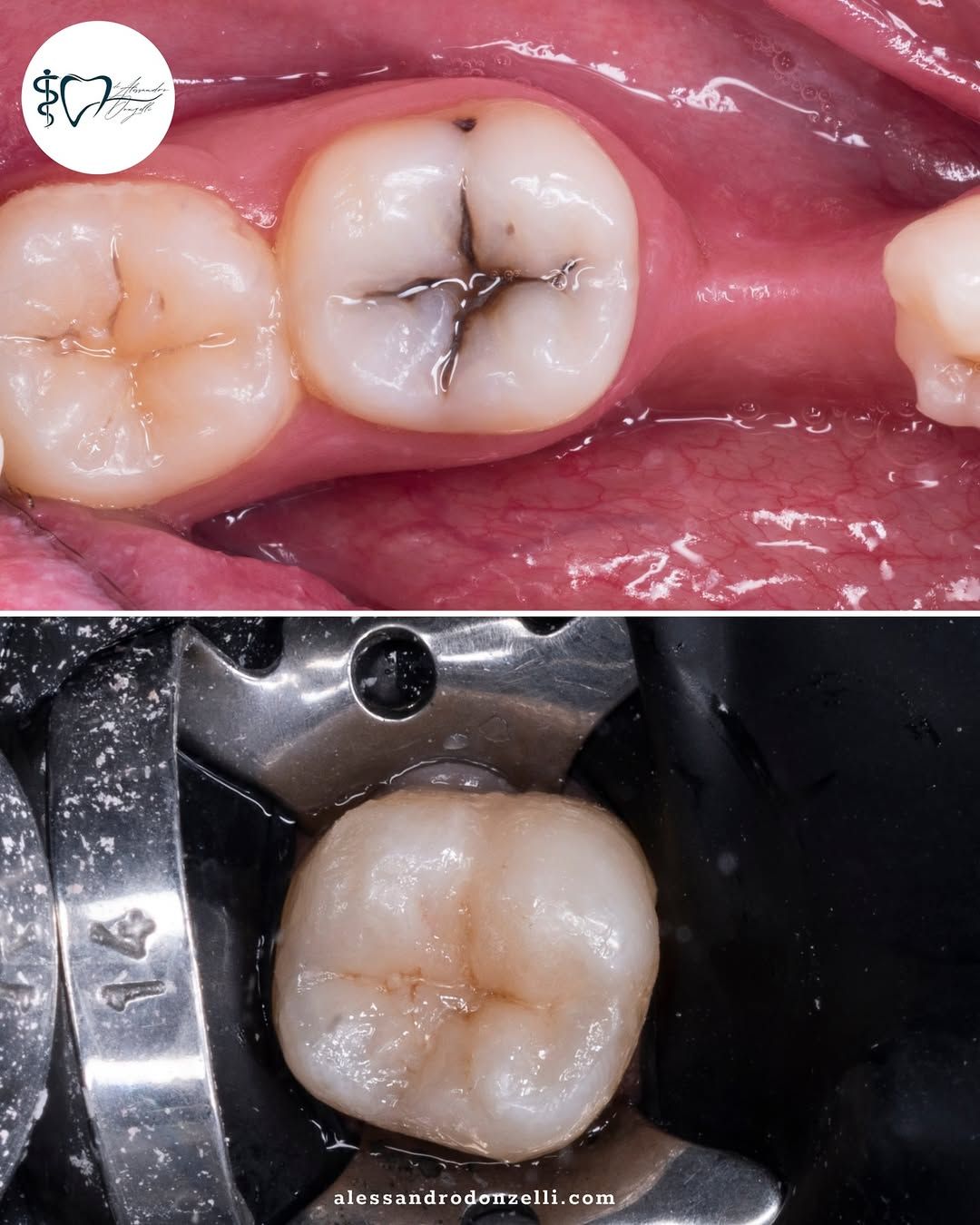 Alessandro Donzelli-11