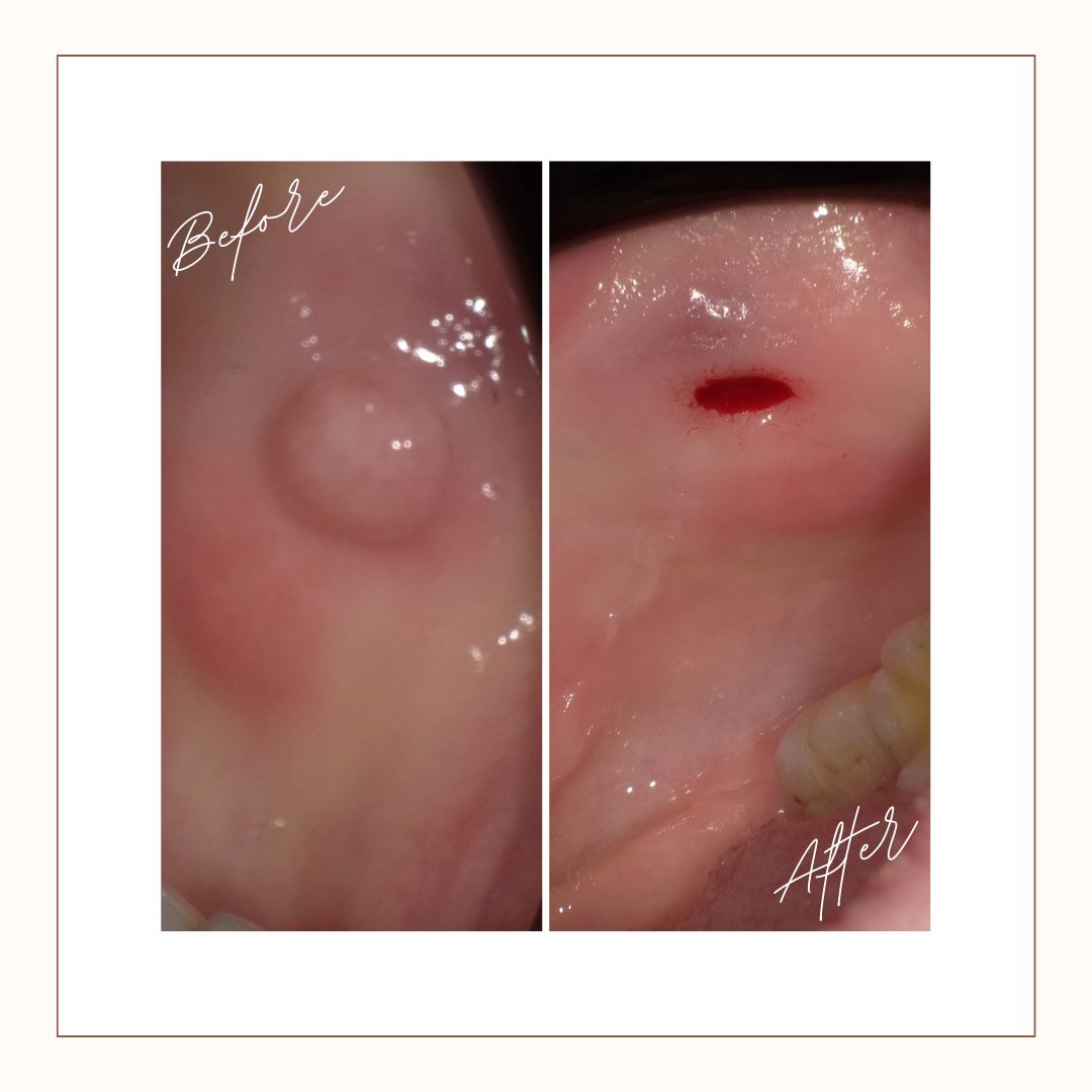 Magdalena Przybysz-25