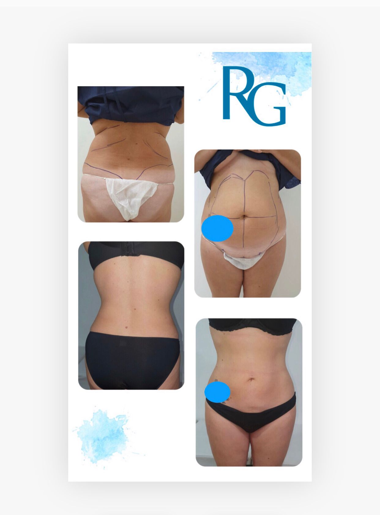 Rafael Gonzalez Oñate-10