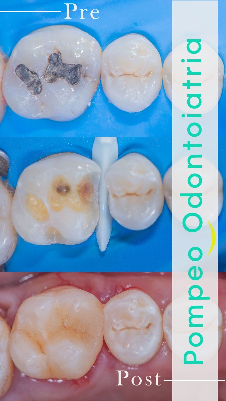 Enrico Maria Pompeo-12