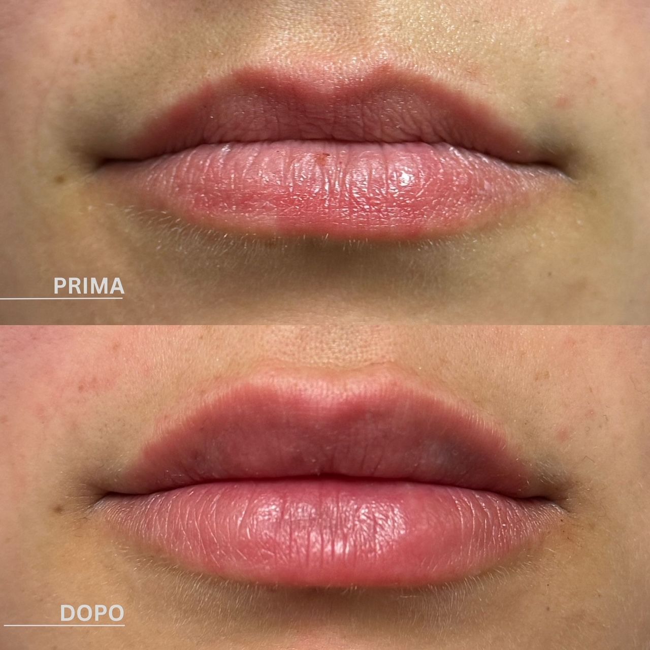 Pier Paolo Ferretti-4