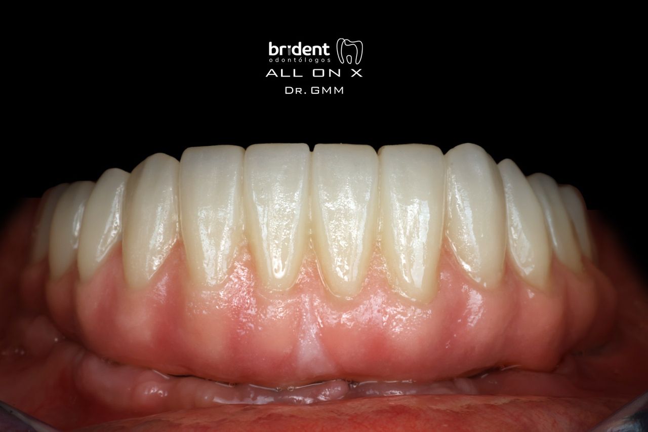 Guillermo Moreno Masiá-56