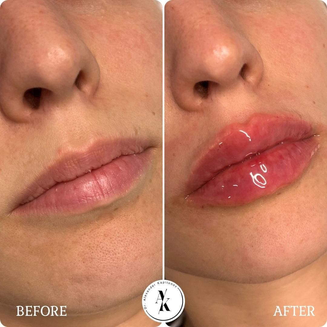 Alexandr Kapitonov-7