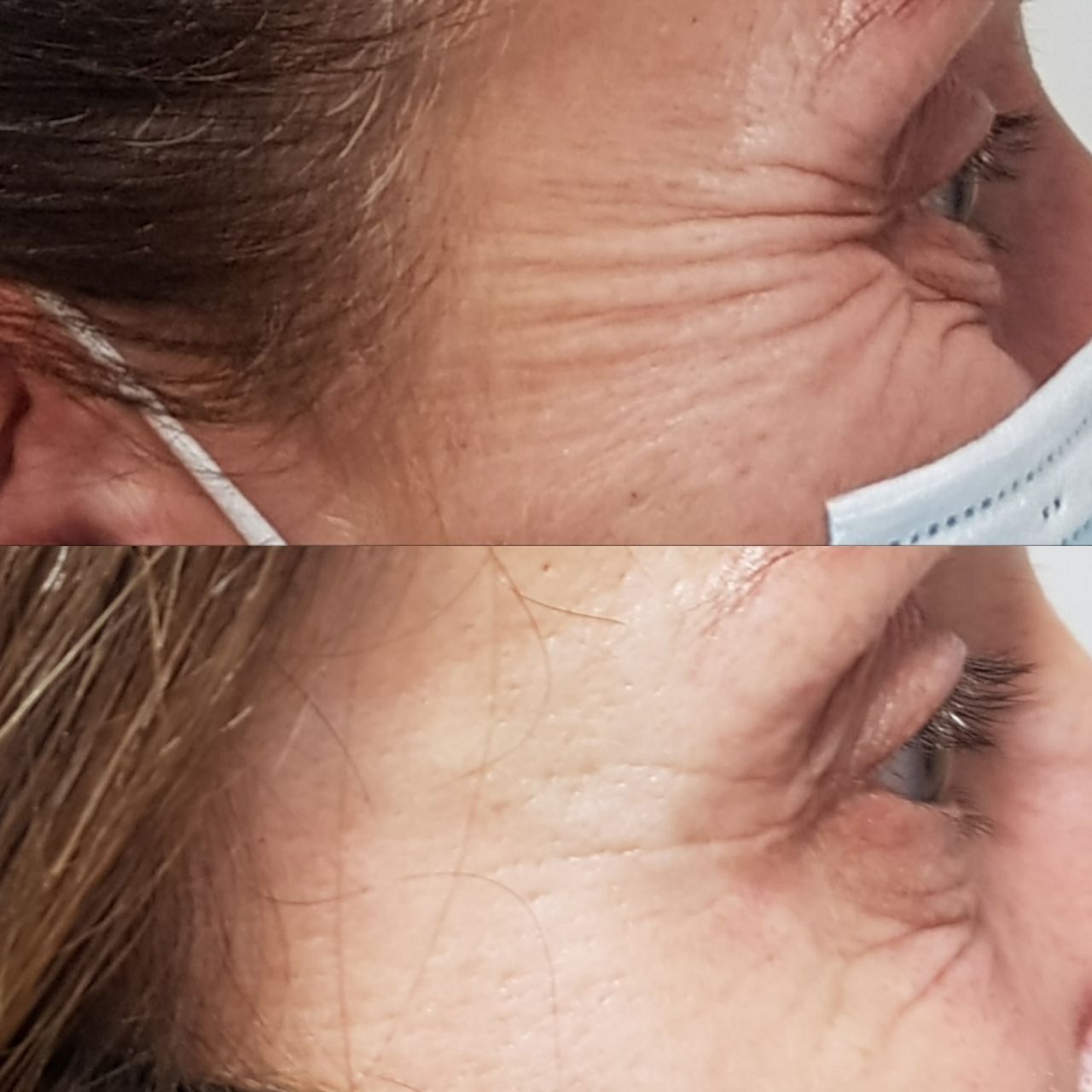 Rosalba Herrero Zerpa-476