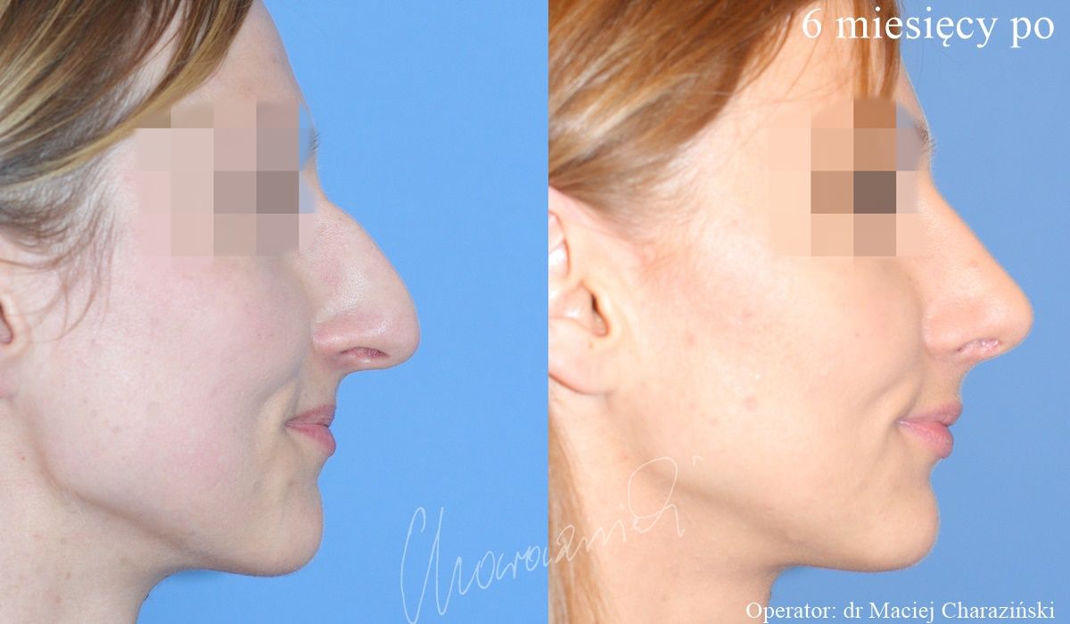 Maciej Charaziński-13