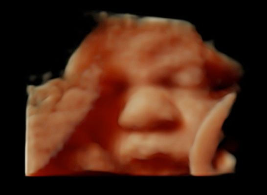 Tommaso Incandela-46