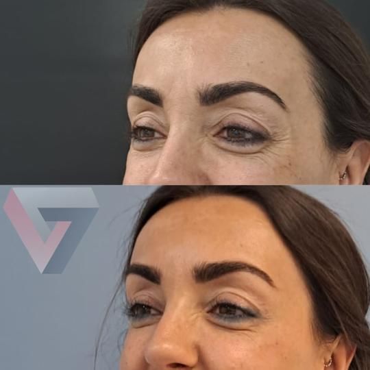 Victoria Trasmonte-50