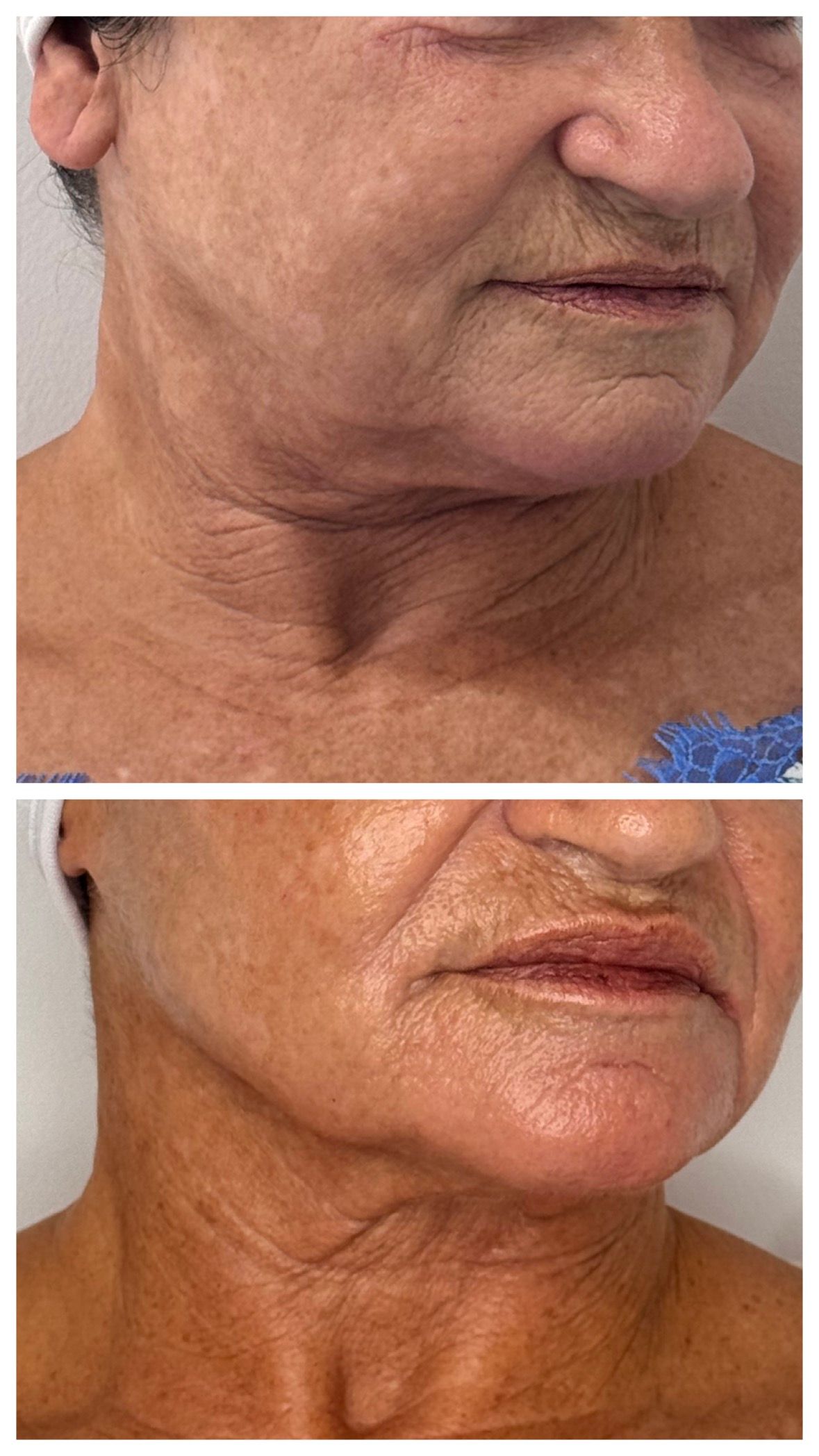 Yessica Corrales Acevedo-4