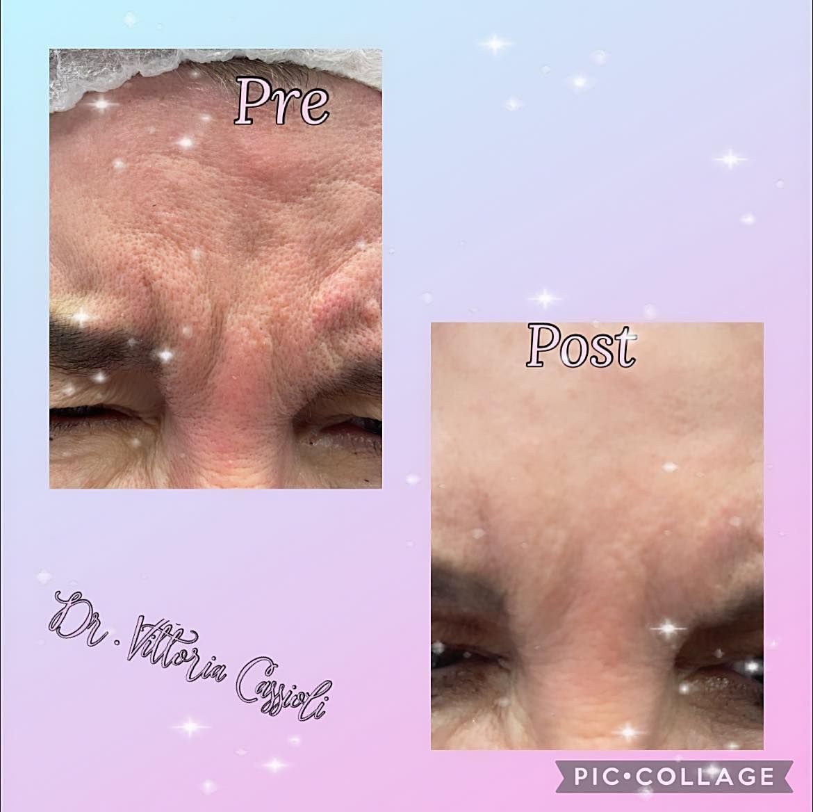 Vittoria Cassioli-66