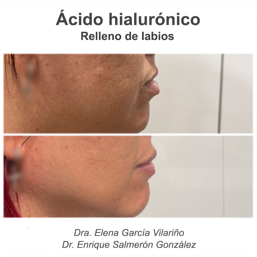 Enrique Salmerón González-75