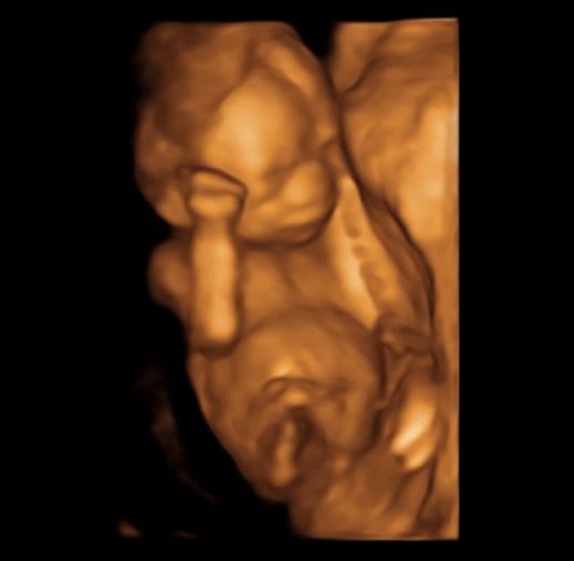 Tommaso Incandela-13