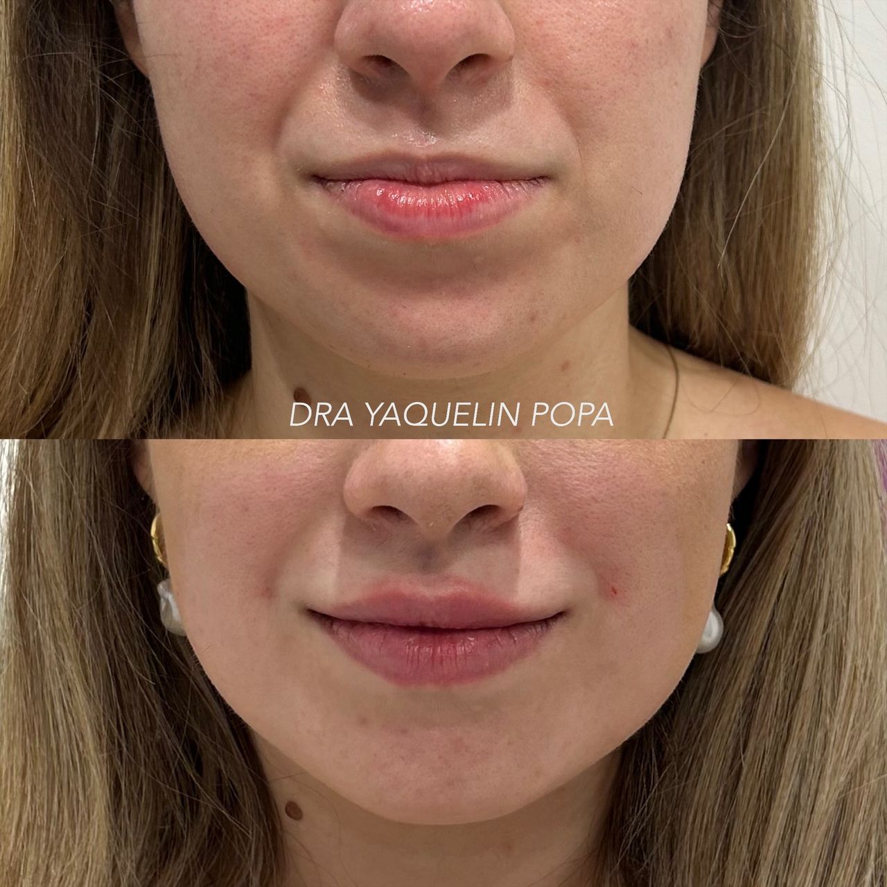 Yaquelin Popa Rosales-4