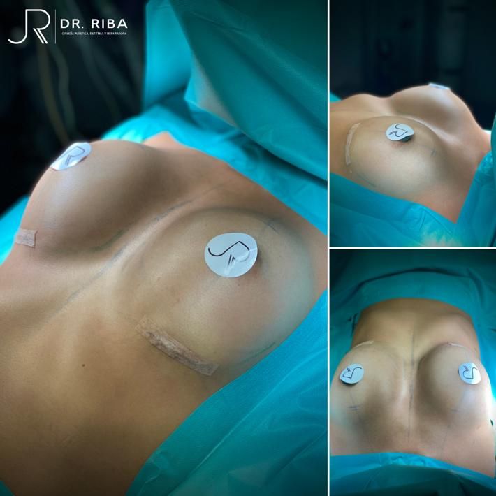 Jordi Riba Vilchez-66