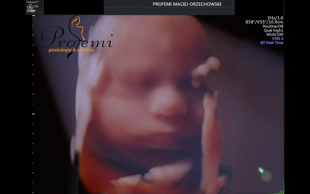 Maciej Orzechowski-22