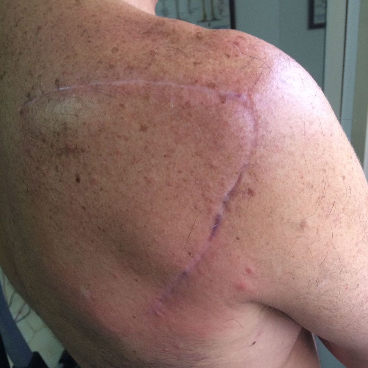 Giuseppe Lombardo-30