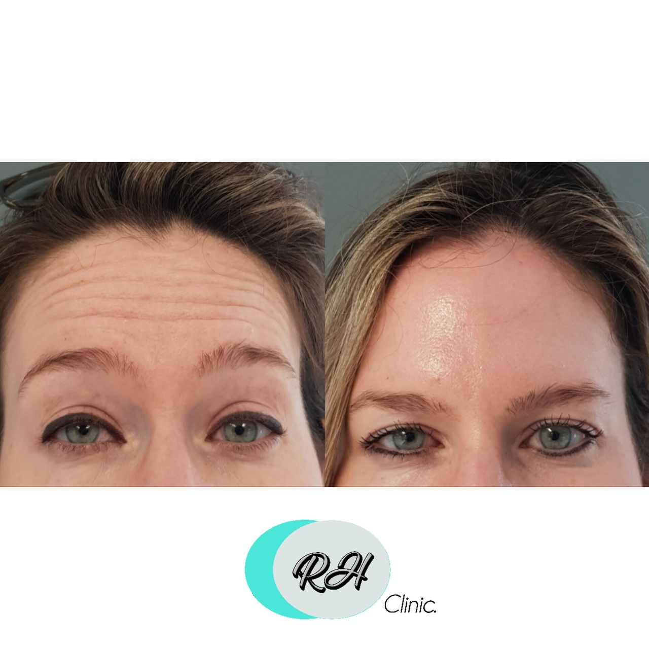 Rosalba Herrero Zerpa-72