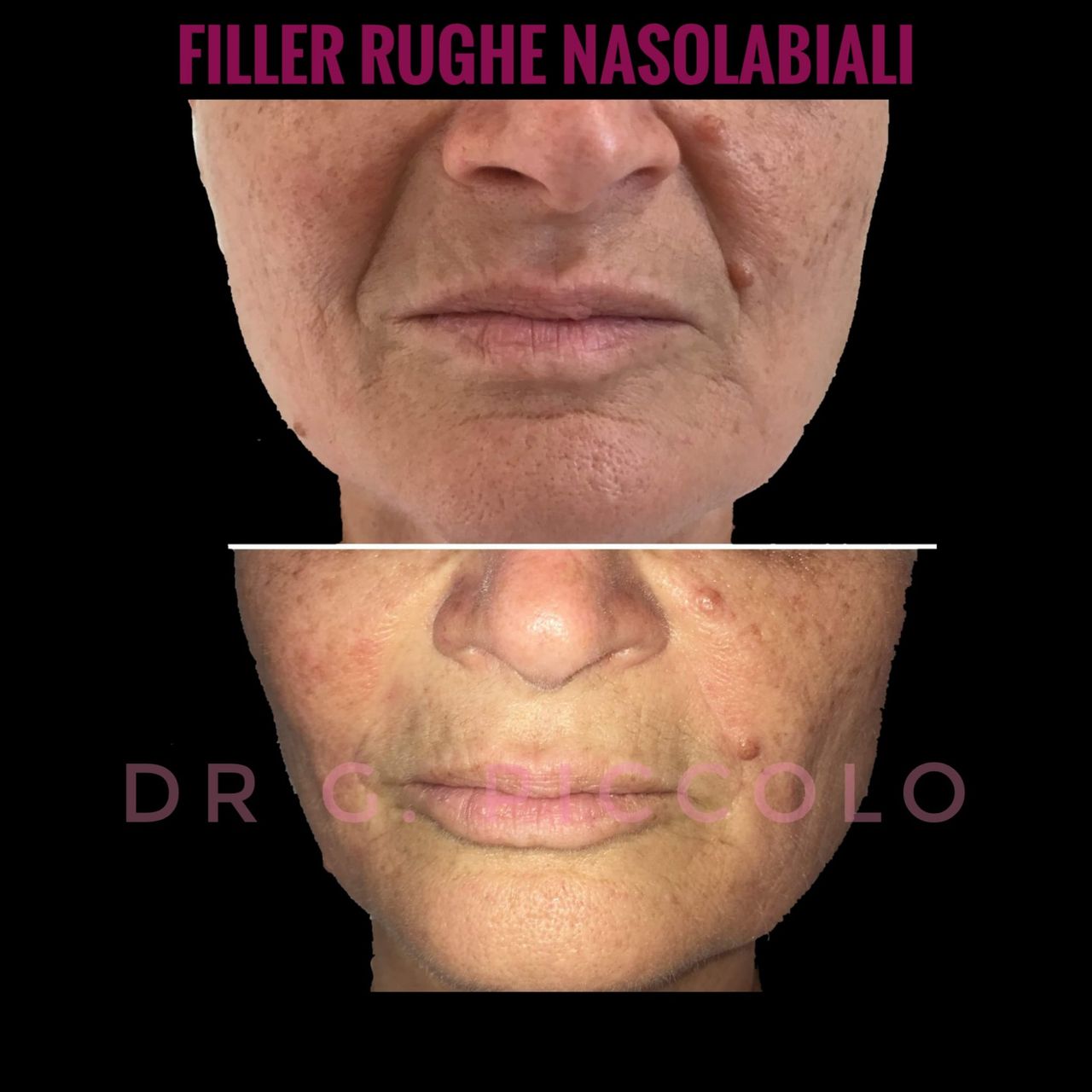 Giuseppina Piccolo-49