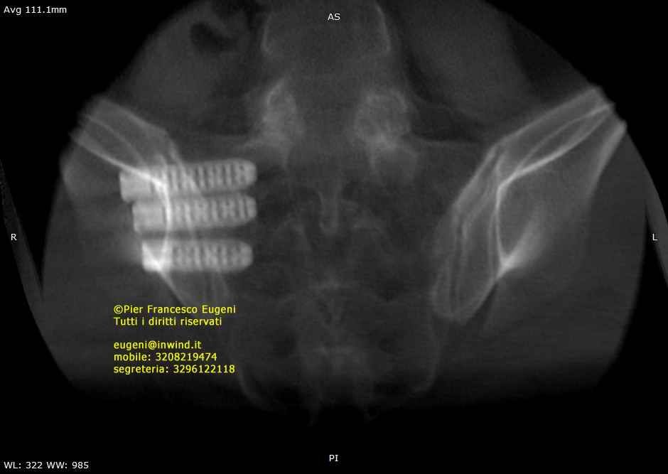 Pier Francesco Eugeni-8