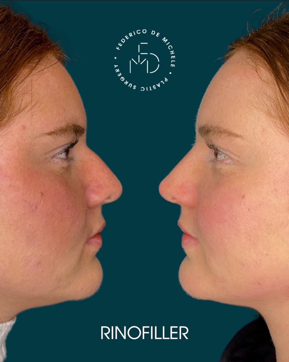 Federico De Michele-6