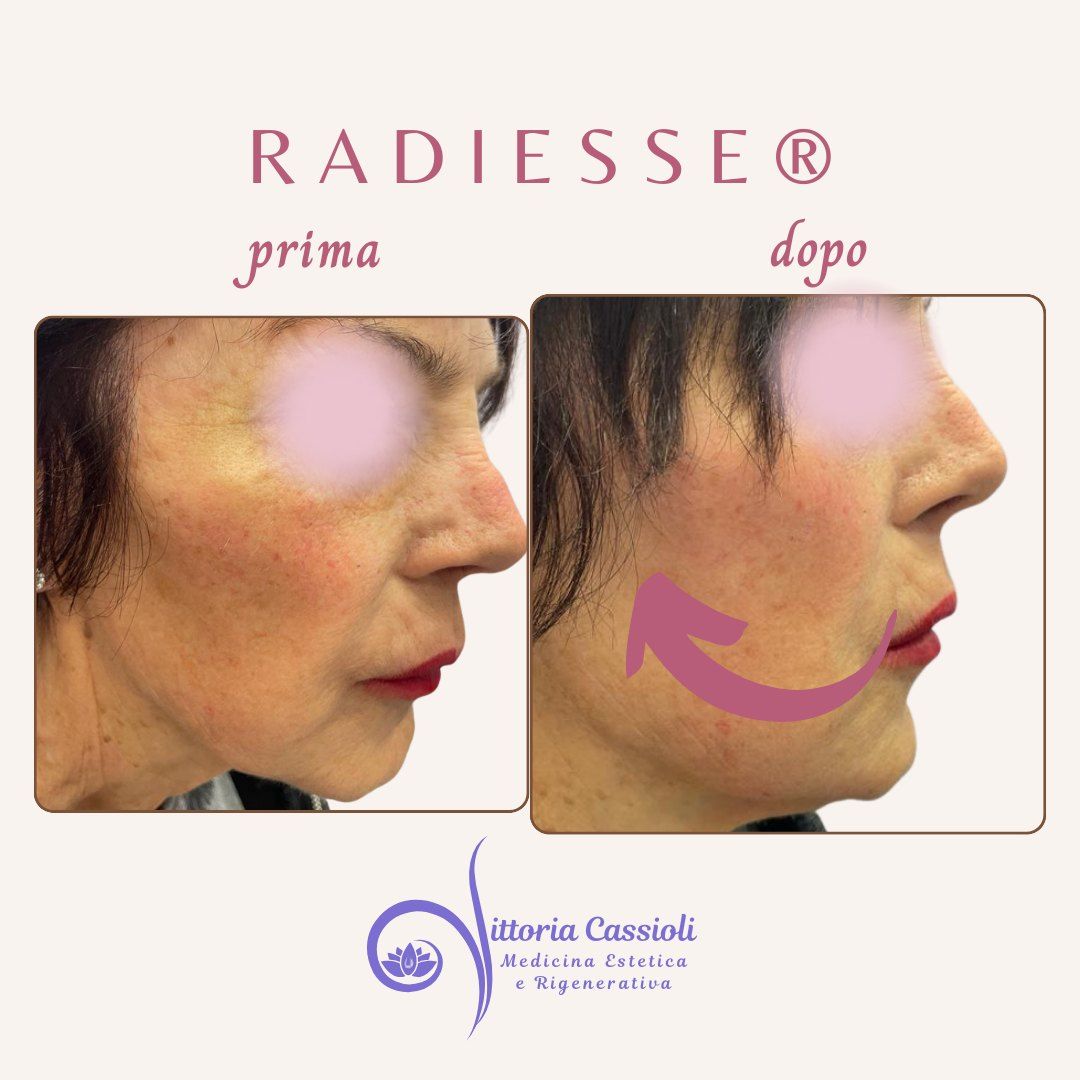 Vittoria Cassioli-46