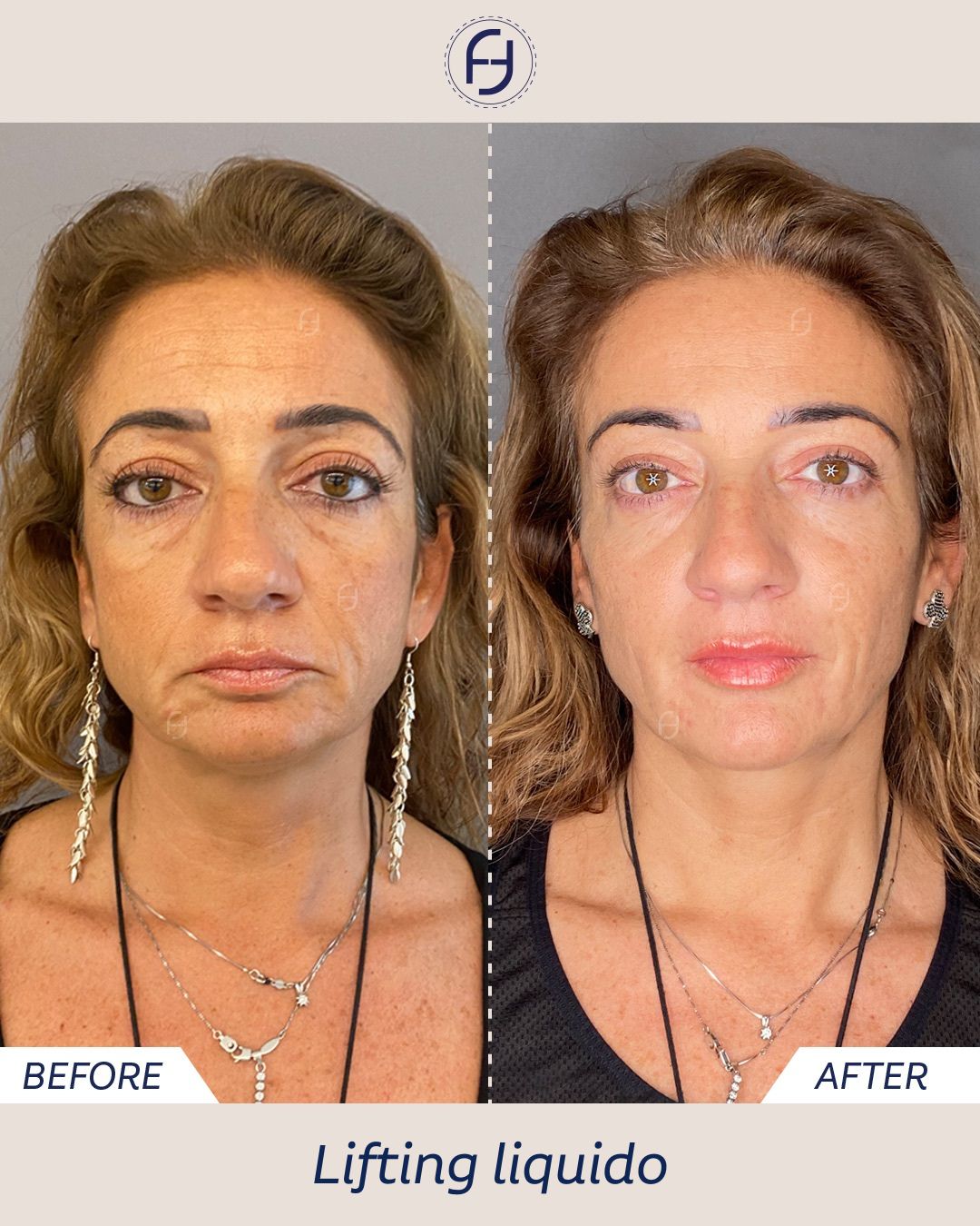 Francesca Flagiello-7