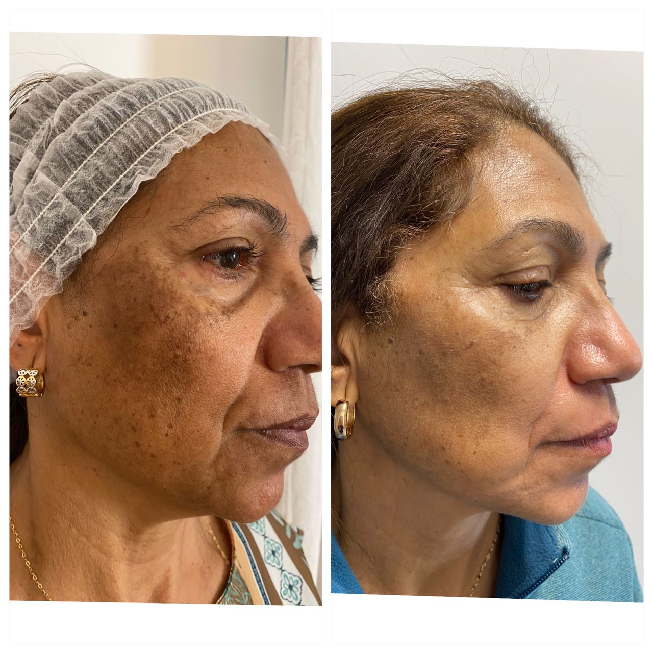 Elisabetta Fabiani-65