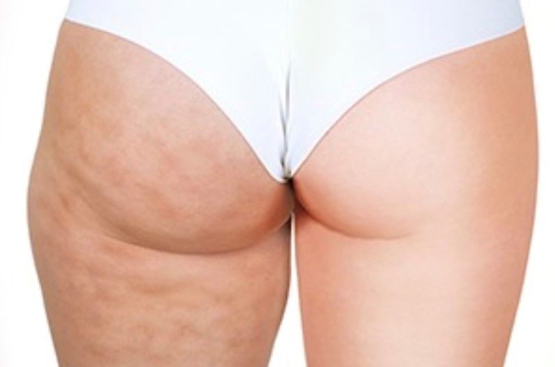 Antonella Napolitano-18