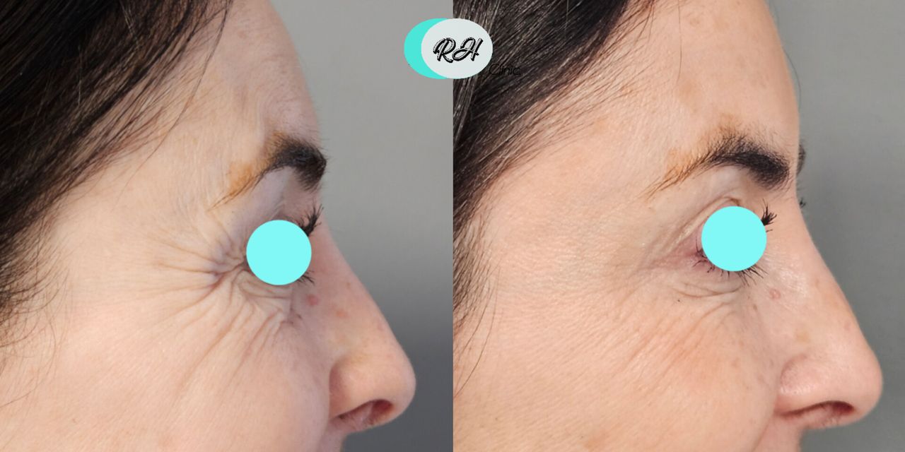 Rosalba Herrero Zerpa-606