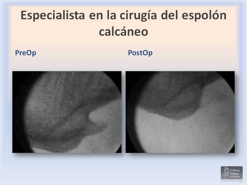 Joan Lozano Freixas-6