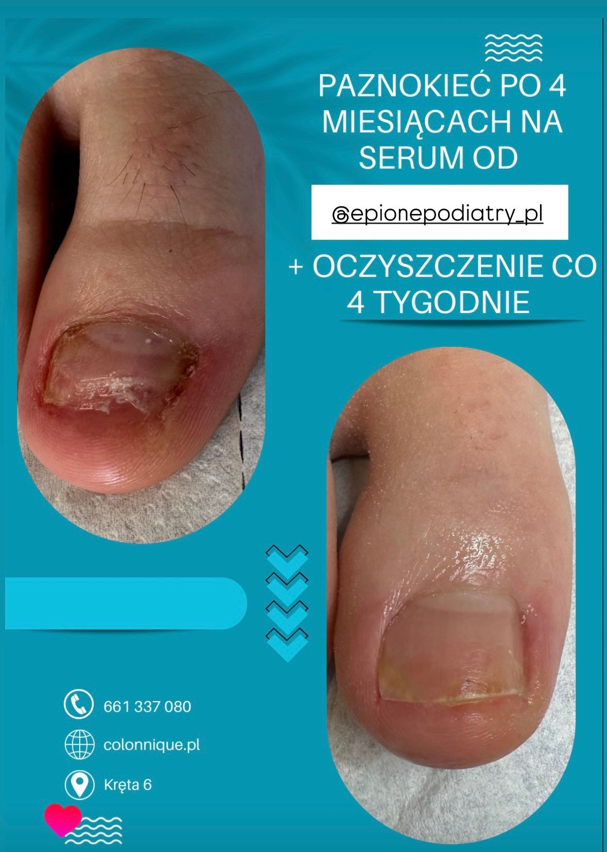 Karolina Colonna-Walewska-1