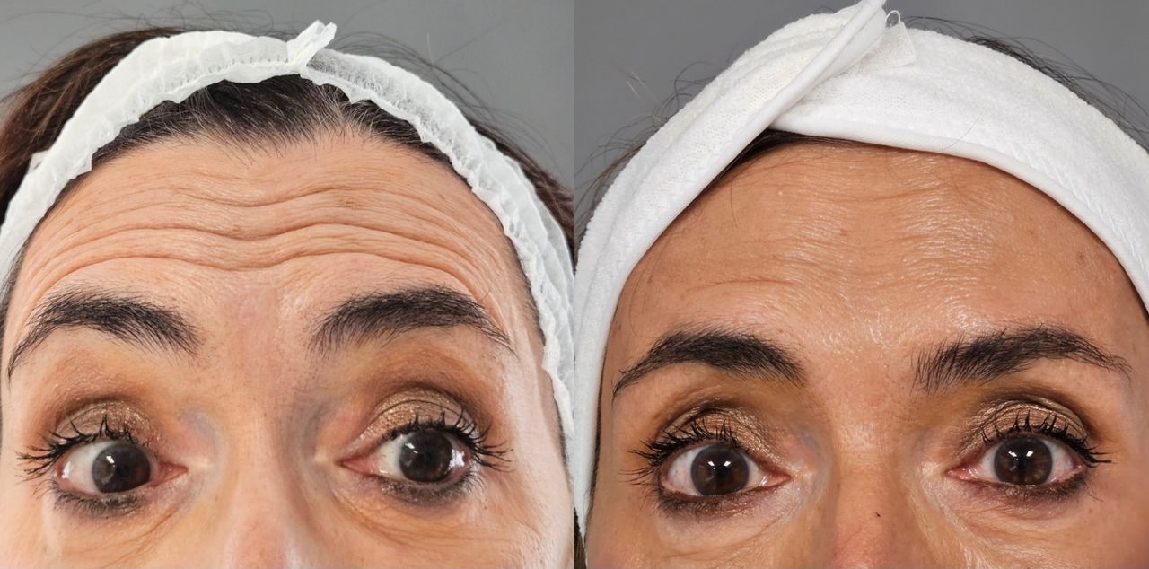 Rosalba Herrero Zerpa-458