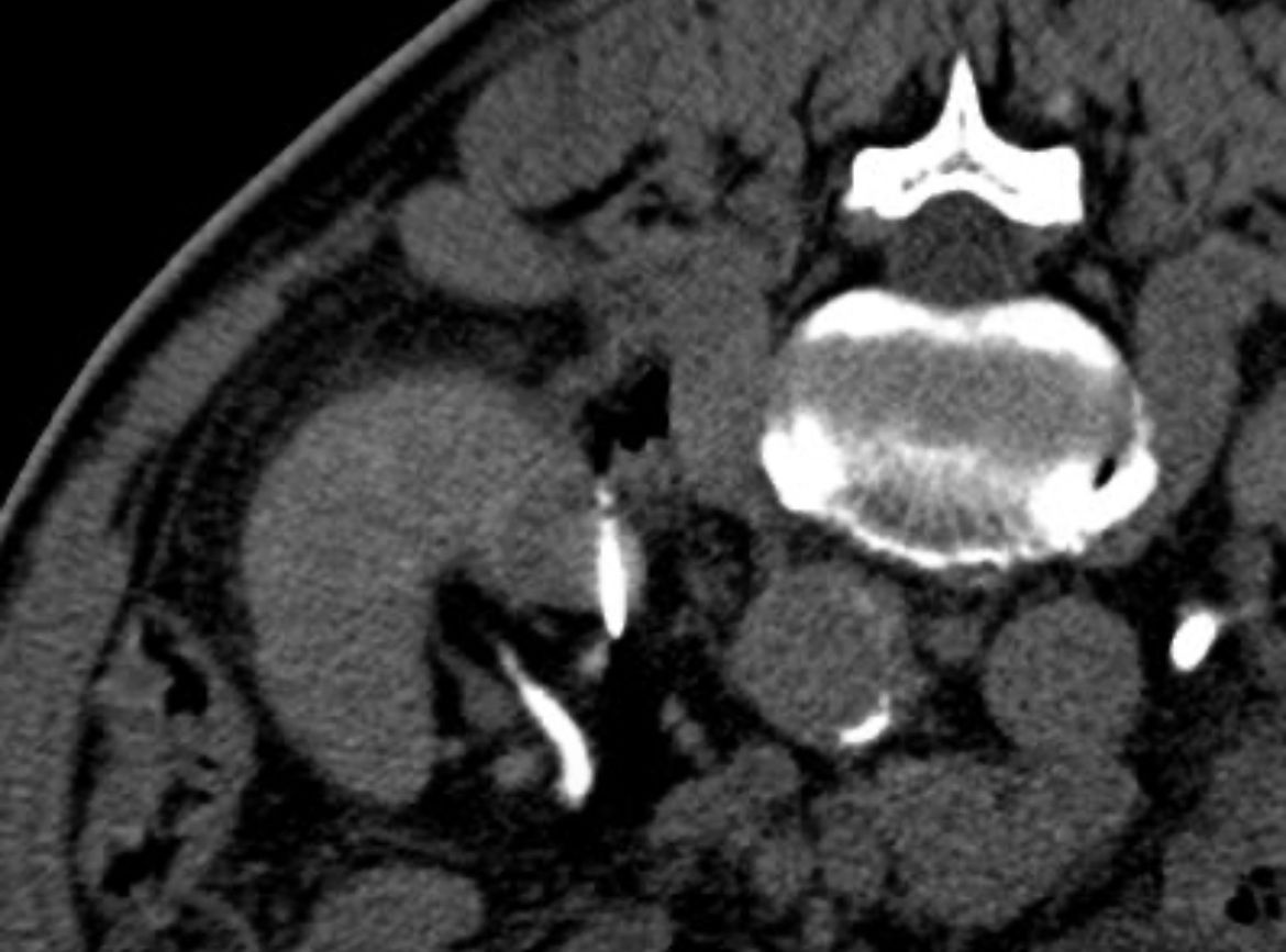 Salvatore Marsico-14
